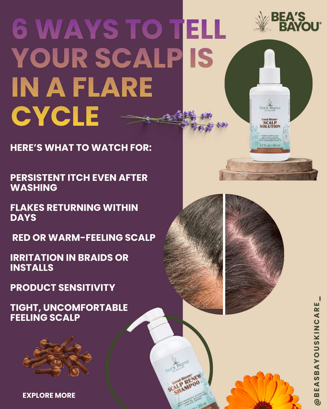 6 Ways to Tell Your Scalp Is in a Flare Cycle - Bea's Bayou Skincare