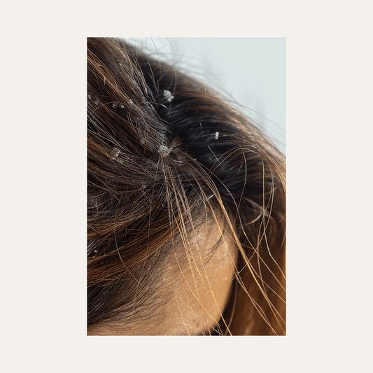 Itchy Scalp Treatment: How To Soothe An Itchy Scalp With Our 3 Easy Steps - Bea's Bayou Skincare
