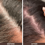 YeastDefense®️ Seborrheic Solution & Prebiotic AHA + BHA Facial Solution - Bea's Bayou Skincare