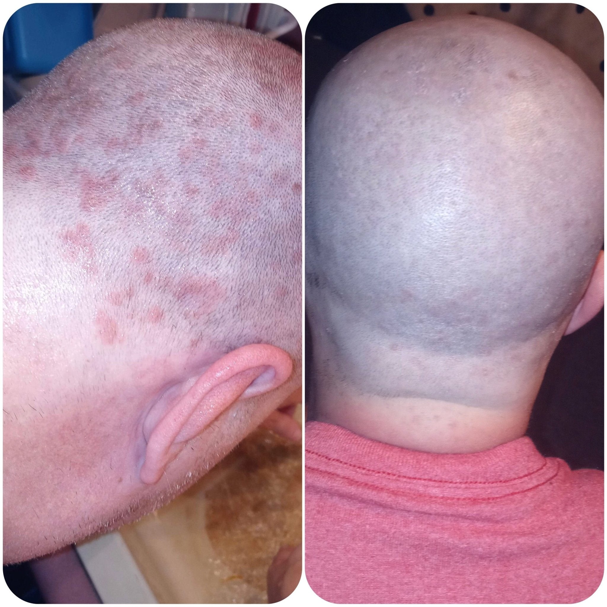Scalp Relief Solution & Gentle Biome - Friendly Facial Fluid: Prebiotic + AHA + BHA - Bea's Bayou Skincare